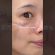 毛穴改善するならコレ！#垢抜け #おすすめ #美容液 #毛穴ケア #pr